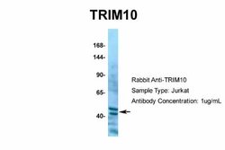TRIM10 Rabbit anti-Human, Polyclonal, Novus Biologicals 0.1 mL; Unconjugated:Antibodies,