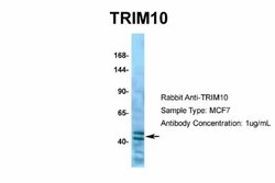 TRIM10 Rabbit anti-Human, Polyclonal, Novus Biologicals 0.1 mL; Unconjugated:Antibodies,