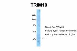 TRIM10 Rabbit anti-Human, Polyclonal, Novus Biologicals 0.1 mL; Unconjugated:Antibodies,
