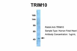 TRIM10 Rabbit anti-Human, Polyclonal, Novus Biologicals 0.1 mL; Unconjugated:Antibodies,