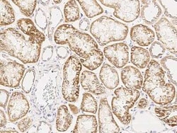 TRIM13 Antibody, Novus Biologicals:Anticuerpos:Anticuerpos primarios