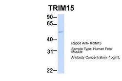 TRIM15 Rabbit anti-Human, Polyclonal, Novus Biologicals 0.1 mL | Buy Online | Novus Biologicals | Fisher Scientific