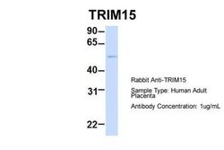 TRIM15 Rabbit anti-Human, Polyclonal, Novus Biologicals 0.1 mL | Buy Online | Novus Biologicals | Fisher Scientific