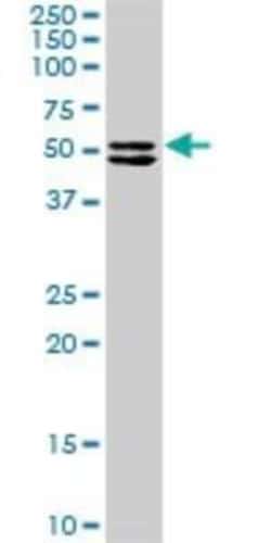 TRIM16 Antibody, Novus Biologicals 0.1 mg | Buy Online | Novus Biologicals | Fisher Scientific