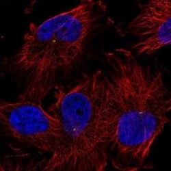 TRIM2 Antibody, Novus Biologicals 25 &mu;L | Buy Online | Novus Biologicals | Fisher Scientific