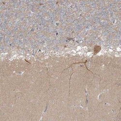 TRIM2 Antibody, Novus Biologicals:Antibodies:Primary Antibodies