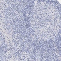 TRIM2 Antibody, Novus Biologicals 25 &mu;L | Buy Online | Novus Biologicals | Fisher Scientific