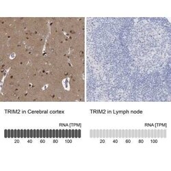TRIM2 Antibody, Novus Biologicals 25 &mu;L | Buy Online | Novus Biologicals | Fisher Scientific