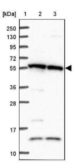 TRIM27 Antibody, Novus Biologicals:Antibodies:Primary Antibodies