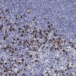 TRIM29 Rabbit anti-Human, Polyclonal, Novus Biologicals 25 &mu;g; Unconjugated:Antibodies,