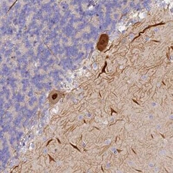 TRIM3/BERP Antibody, Novus Biologicals 25 &mu;L, Unconjugated:Antibodies,