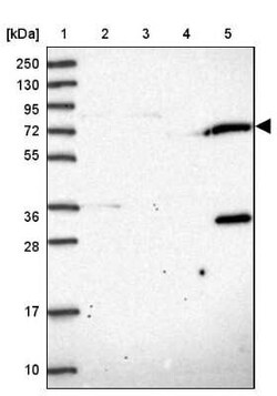 TRIM3/BERP Antibody, Novus Biologicals 25 &mu;L, Unconjugated:Antibodies,