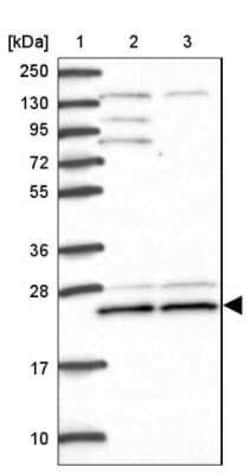 TRIM3/BERP Antibody, Novus Biologicals 0.1 mL, Unconjugated:Antibodies,