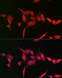TRIM31 Antibody - BSA Free, Novus Biologicals 0.1 mL; Unconjugated:Antibodies,