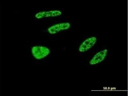 TRIM32 Antibody (2E5), Novus Biologicals 0.1 mg | Buy Online | Novus Biologicals | Fisher Scientific