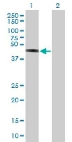 TRIM44 Antibody, Novus Biologicals 0.05 mg | Buy Online | Novus Biologicals | Fisher Scientific