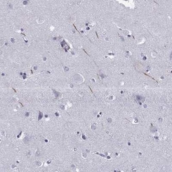 TRIM46 Antibody, Novus Biologicals 25ul; Unconjugated:Antibodies, Polyclonal