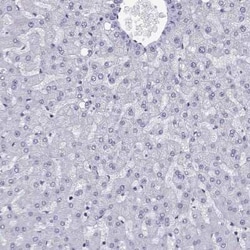 TRIM46 Antibody, Novus Biologicals 25ul; Unconjugated:Antibodies, Polyclonal