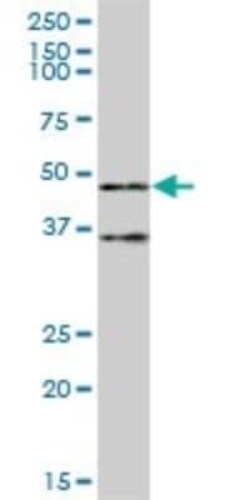 TRIM62 Antibody, Novus Biologicals 0.05 mg | Buy Online | Novus Biologicals | Fisher Scientific