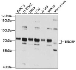 TRIOBP Antibody - BSA Free, Novus Biologicals 0.02 mL, Unconjugated:Antibodies,