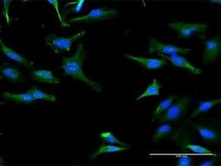 TRIT1 Antibody, Novus Biologicals 0.05 mg | Buy Online | Novus Biologicals | Fisher Scientific