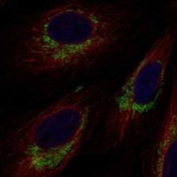 TRIT1 Rabbit anti-Human, Polyclonal, Novus Biologicals:Antibodies:Primary