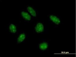 TRMT9B Antibody, Novus Biologicals 0.05 mg | Buy Online | Novus Biologicals | Fisher Scientific