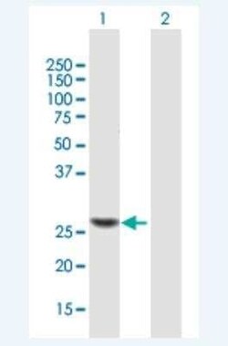 TRMU Antibody, Novus Biologicals 50 &mu;g; Unconjugated:Antibodies