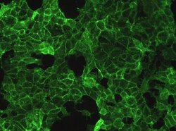 TROP-2 Rabbit anti-Human, Clone: 1, Novus Biologicals 100 &mu;g; Unconjugated:Antibodies,