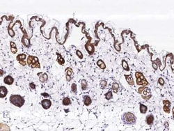 TROP-2 Rabbit anti-Mouse, Clone: 46, Novus Biologicals:Antibodies:Primary