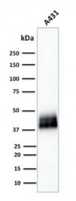 TROP-2 Antibody (TACSTD2/2151), Novus Biologicals 20 &mu;g; Unconjugated:Antibodies,