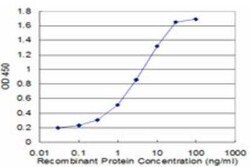 Novus Biologicals TROVE2 Antibody (2E10), Novus Biologicals 0.1 mg | Buy Online | Novus Biologicals&trade; | Fisher Scientific