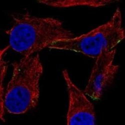 TRP2 Rabbit anti-Human, Polyclonal, Novus Biologicals 25 &mu;g; Unconjugated:Antibodies,
