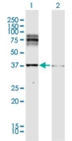 TRP2 Antibody, Novus Biologicals 0.1 mg | Buy Online | Novus Biologicals | Fisher Scientific