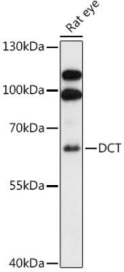 TRP2 Antibody - Azide and BSA Free, Novus Biologicals:Antibodies:Primary