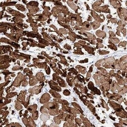 TRP7 Antibody, Novus Biologicals 25 &mu;L; Unconjugated:Antibodies, Polyclonal