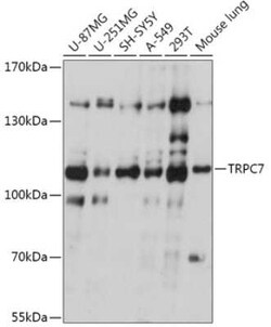 TRP7 Antibody - Azide and BSA Free, Novus Biologicals 0.02 mL; Unconjugated:Antibodies,