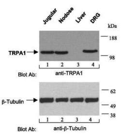 TRPA1 Antibody (6G8), Novus Biologicals 0.1 mg | Buy Online | Novus Biologicals | Fisher Scientific