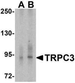 TRPC3 Antibody - BSA Free, Novus Biologicals 0.1 mg | Buy Online | Novus Biologicals | Fisher Scientific