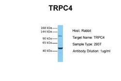 TRPC4 Rabbit anti-Human, Polyclonal, Novus Biologicals 0.1 mL | Buy Online | Novus Biologicals | Fisher Scientific