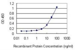 TRPC5 Antibody (1C8), Novus Biologicals 0.1 mg; Unconjugated:Antibodies,