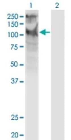 TRPC5 Antibody (1C8), Novus Biologicals 0.1 mg; Unconjugated:Antibodies,