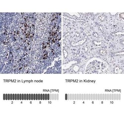 TRPM2 Antibody, Novus Biologicals:Antibodies:Primary Antibodies