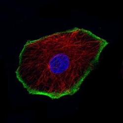 TRPM4 Antibody (CL11214), Novus Biologicals:Antibodies:Primary Antibodies
