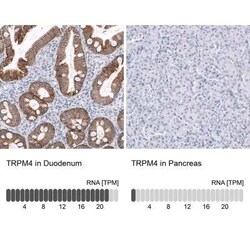 TRPM4 Antibody (CL11214), Novus Biologicals:Antibodies:Primary Antibodies