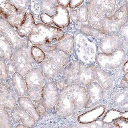 TRPM4 Antibody (CL11214), Novus Biologicals:Antibodies:Primary Antibodies