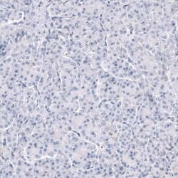 TRPM4 Antibody (CL11214), Novus Biologicals:Antibodies:Primary Antibodies