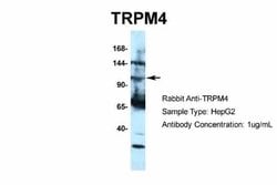 TRPM4 Antibody, Novus Biologicals 100 &mu;L | Buy Online | Novus Biologicals | Fisher Scientific