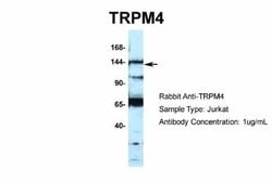 TRPM4 Antibody, Novus Biologicals 100 &mu;L | Buy Online | Novus Biologicals | Fisher Scientific