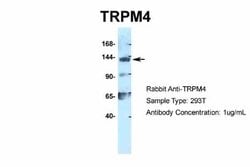 TRPM4 Antibody, Novus Biologicals 100 &mu;L | Buy Online | Novus Biologicals | Fisher Scientific